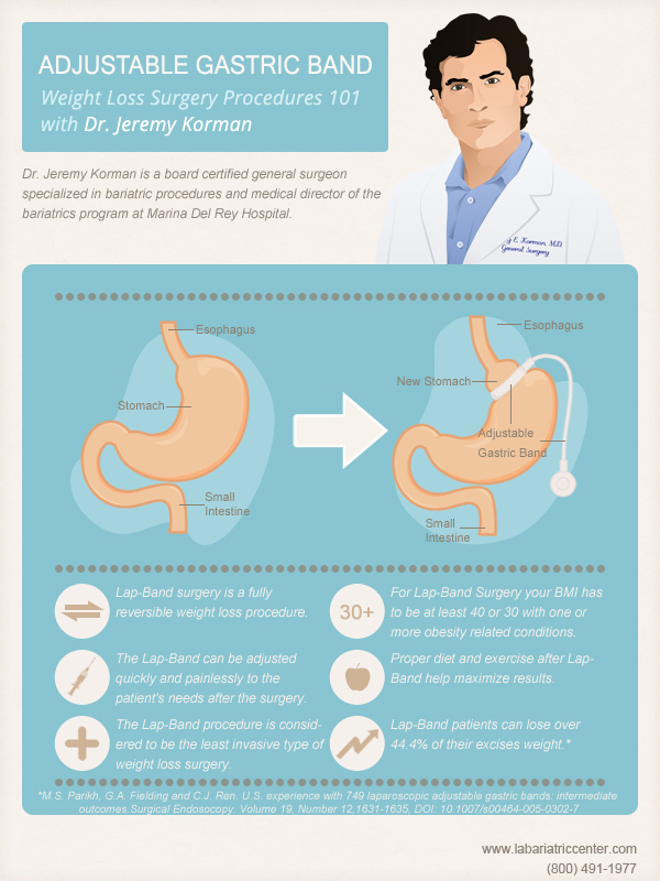 Lap Band With Dr. Jeremy Korman