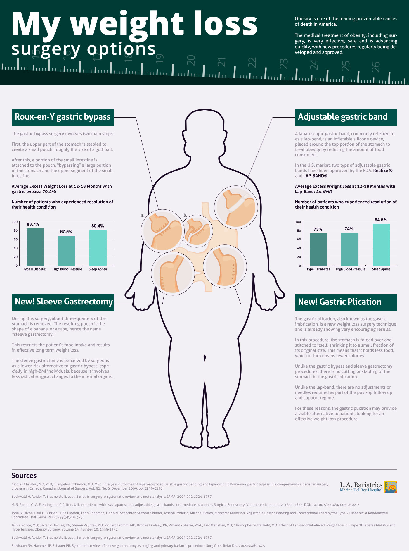Infographic on Weight Loss Surgery Options